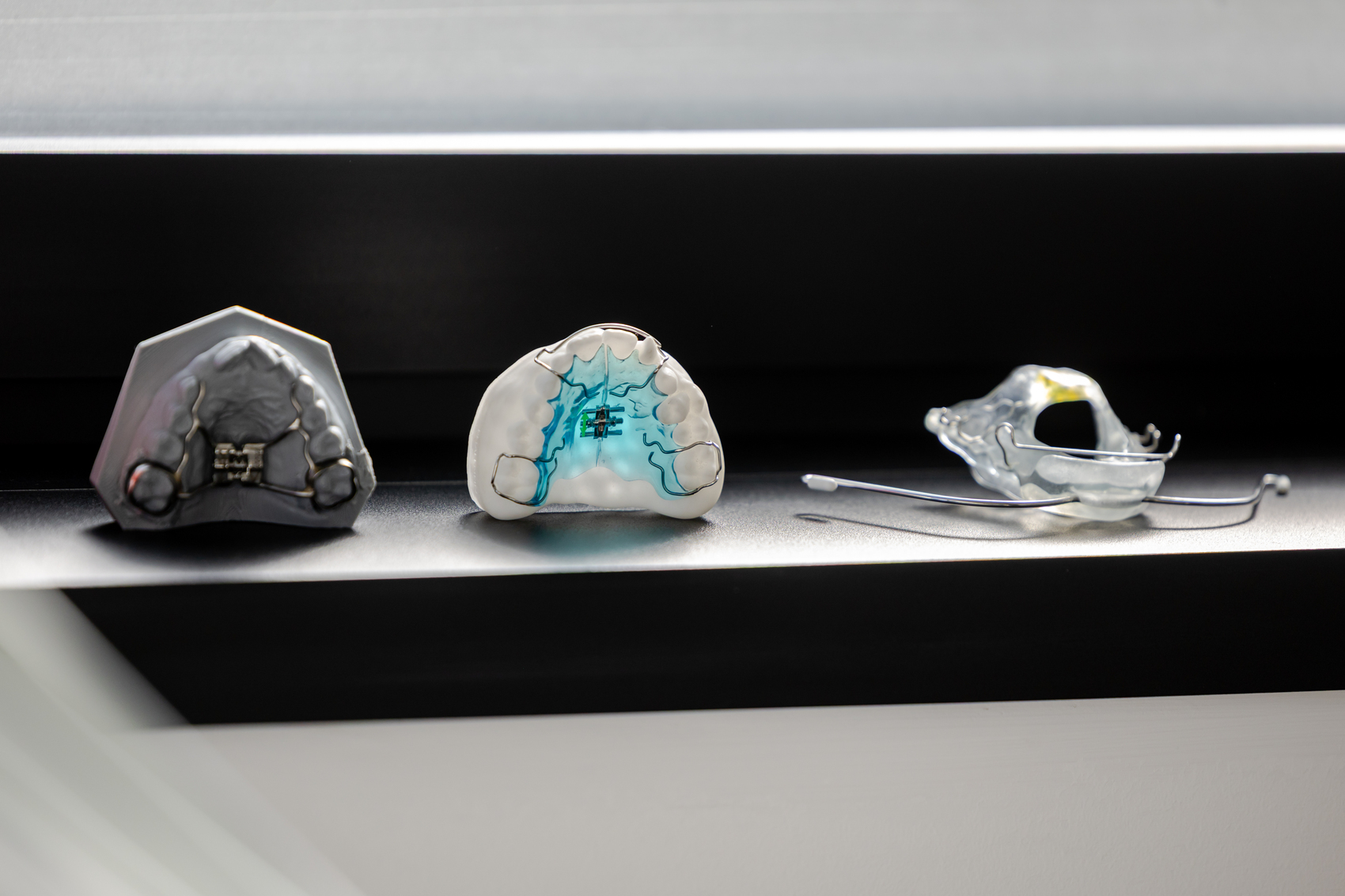 Orthodontie pour enfants à Amiens – Dury
